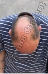 Head Hair Man Casual Slim Average Bald Street photo references